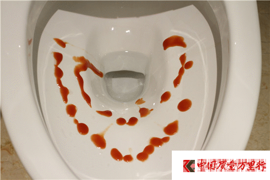 智能馬桶深度體驗(yàn)記:TOTO座便器居然有這么多槽點(diǎn)!