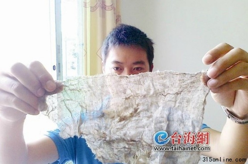 女子產子后體內遺留紗布醫(yī)院稱系操作失誤所致