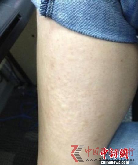 南京水魔方致游客瘙癢衛(wèi)生部門稱余氯含量超標(biāo)