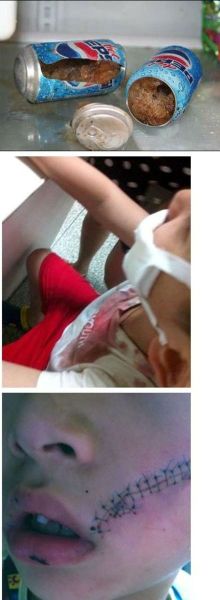上海嘉定一男孩從冰箱冷凍室拿出一聽百事可樂,開啟瞬間突然發(fā)生爆炸。圖片來源:消費(fèi)者微博