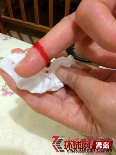 海爾地產(chǎn)掉落的瓷磚割傷業(yè)主的手 海爾地產(chǎn)掉落的瓷磚割傷業(yè)主的手