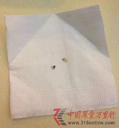 市民劉先生在萬和春就餐時崩落的烤瓷牙碎片